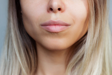 Filler labbra: i benefici estetici e non solo del trattamento più amato dai vip